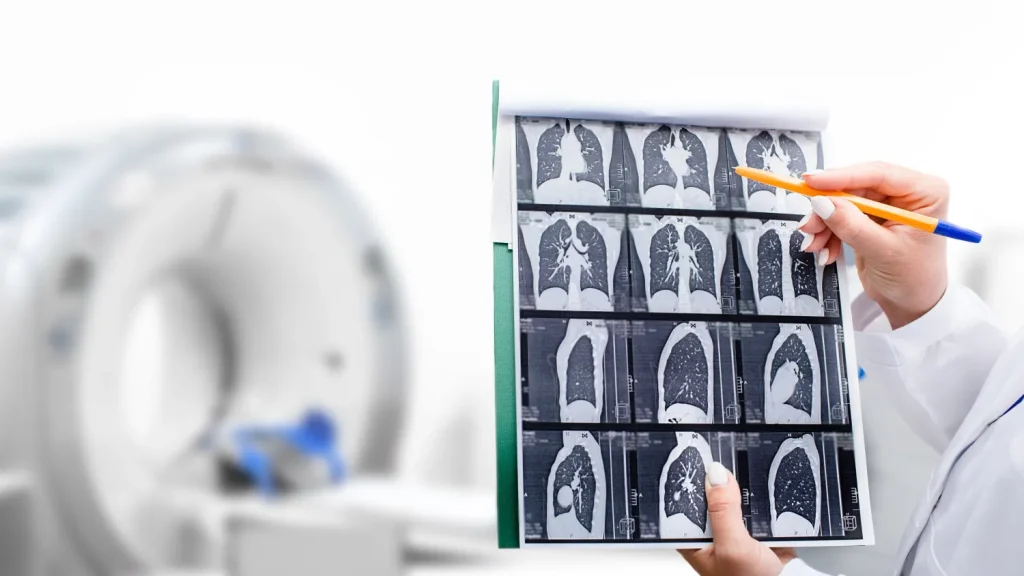 Lung Screening for Smokers – Early Detection Can Make the Difference | RMC