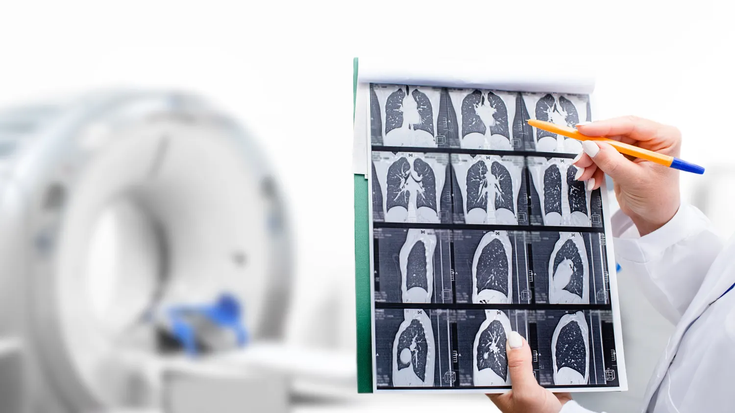 Lung Screening for Smokers – Early Detection Can Make the Difference | RMC