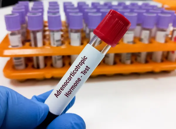 Comprehensive Male Hormone Panels