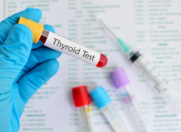 Thyroid Function Tests